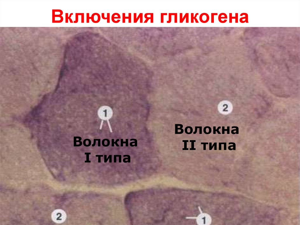 Включения гликогена