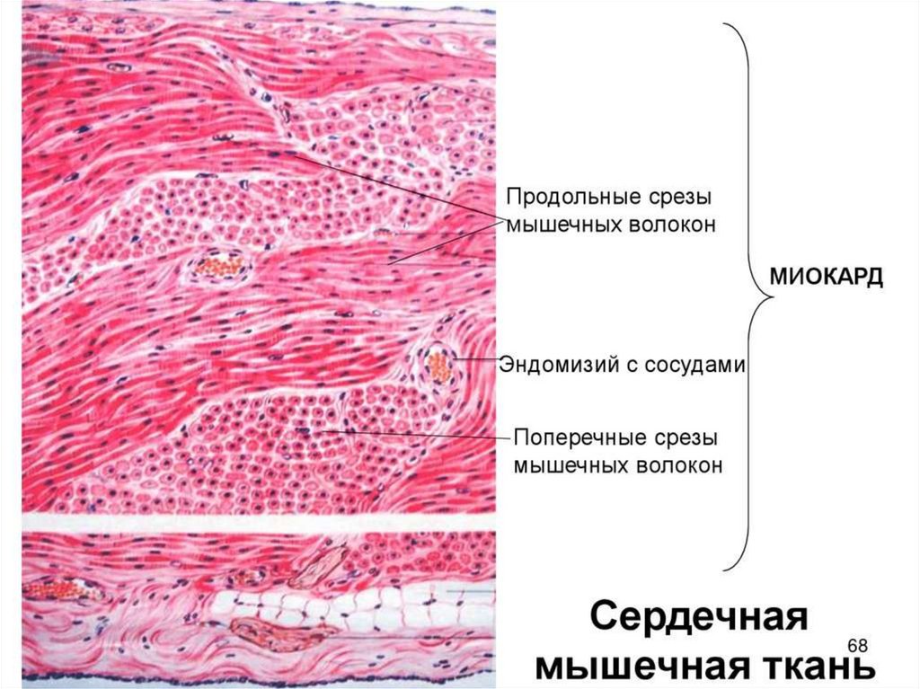 Стенка сердца