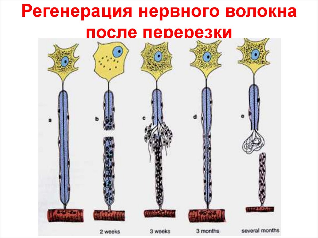Регенерация нервного волокна после перерезки