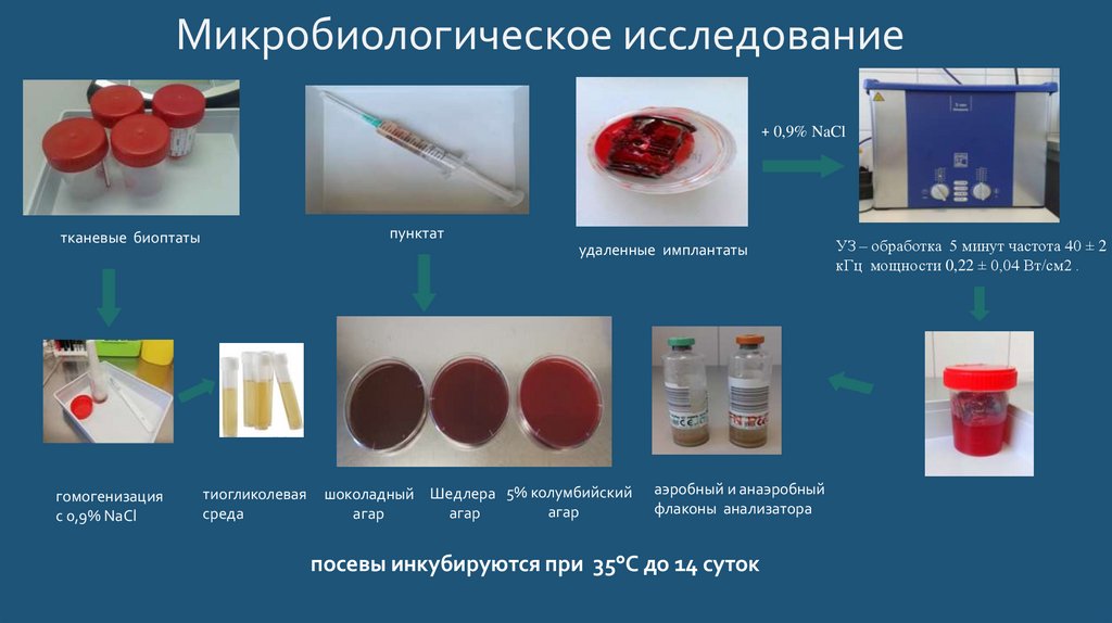 Микробиологическое исследование