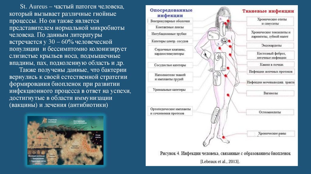 St. Аureus – частый патоген человека, который вызывает различные гнойные процессы. Но он также является представителем