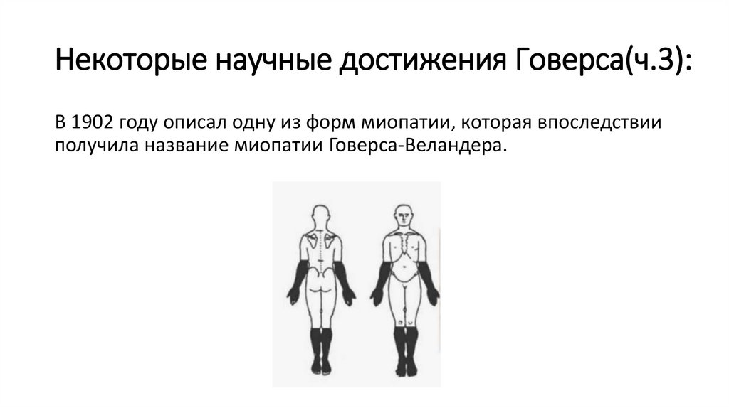 Некоторые научные достижения Говерса(ч.3):