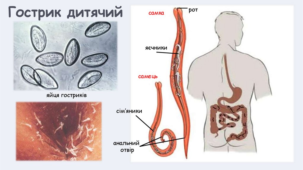 Гострик дитячий