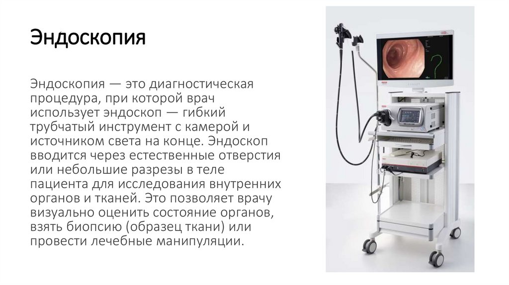 Эндоскопия