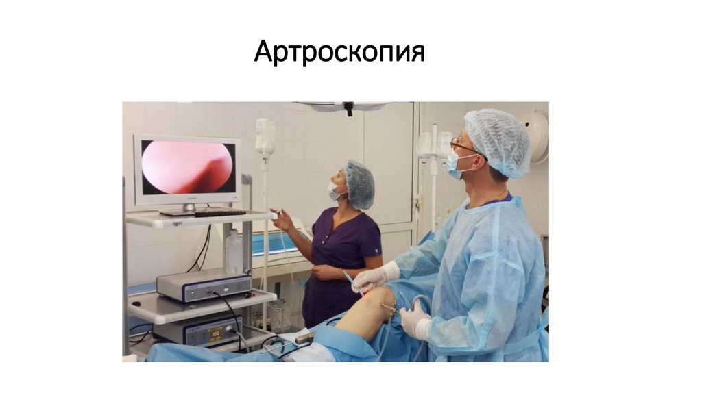Артроскопия