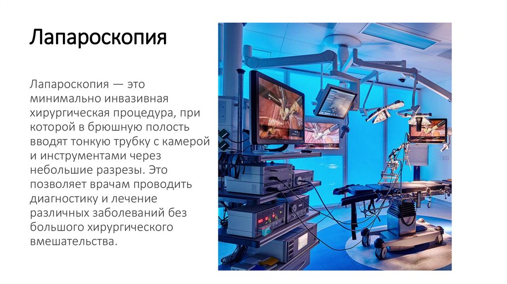 Лапароскопия