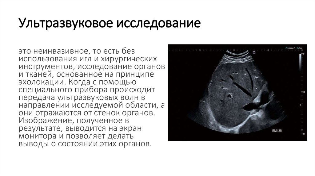 Ультразвуковое исследование