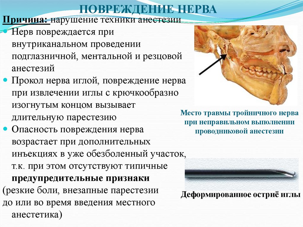 ПОВРЕЖДЕНИЕ НЕРВА