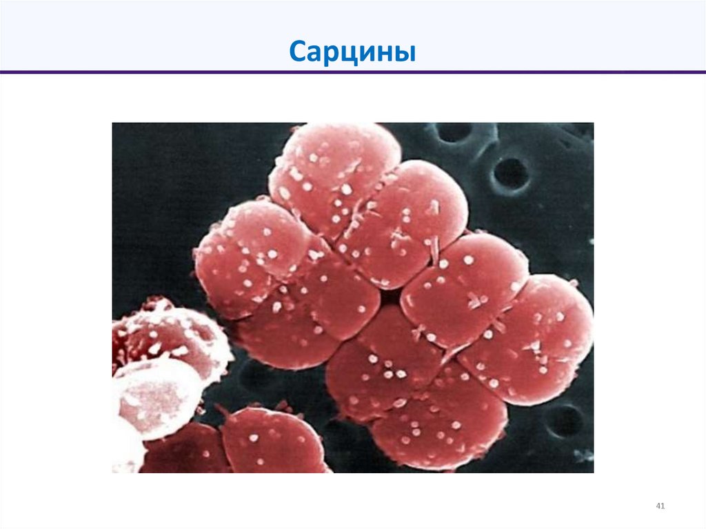 Сарцины