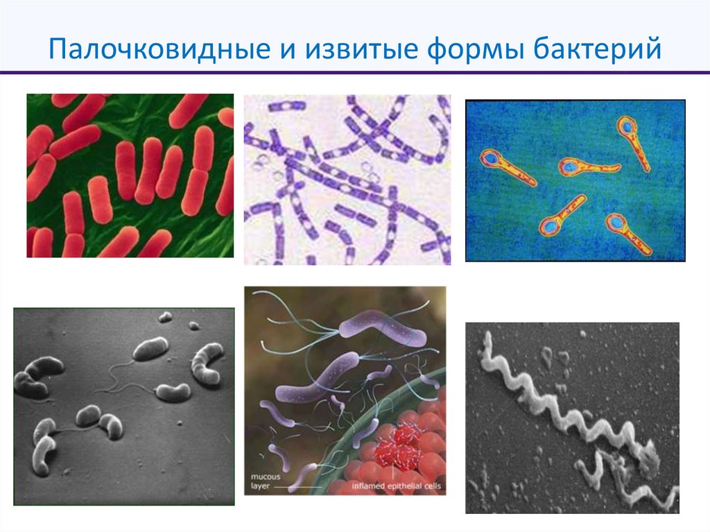 Палочковидные и извитые формы бактерий