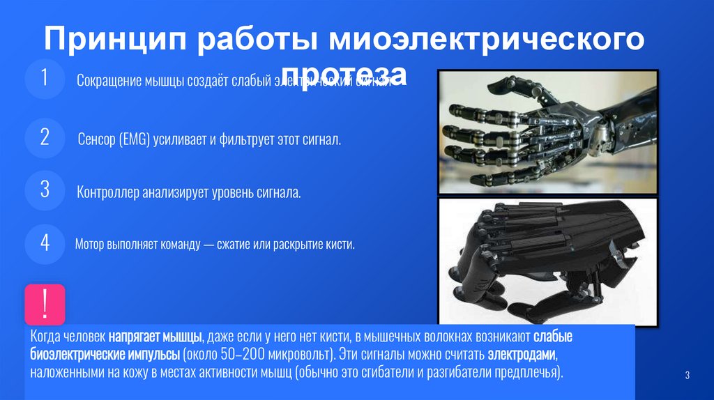 Принцип работы миоэлектрического протеза