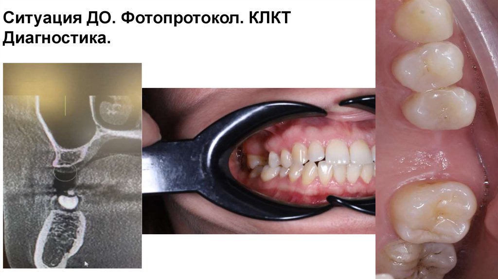 Ситуация ДО. Фотопротокол. КЛКТ Диагностика.
