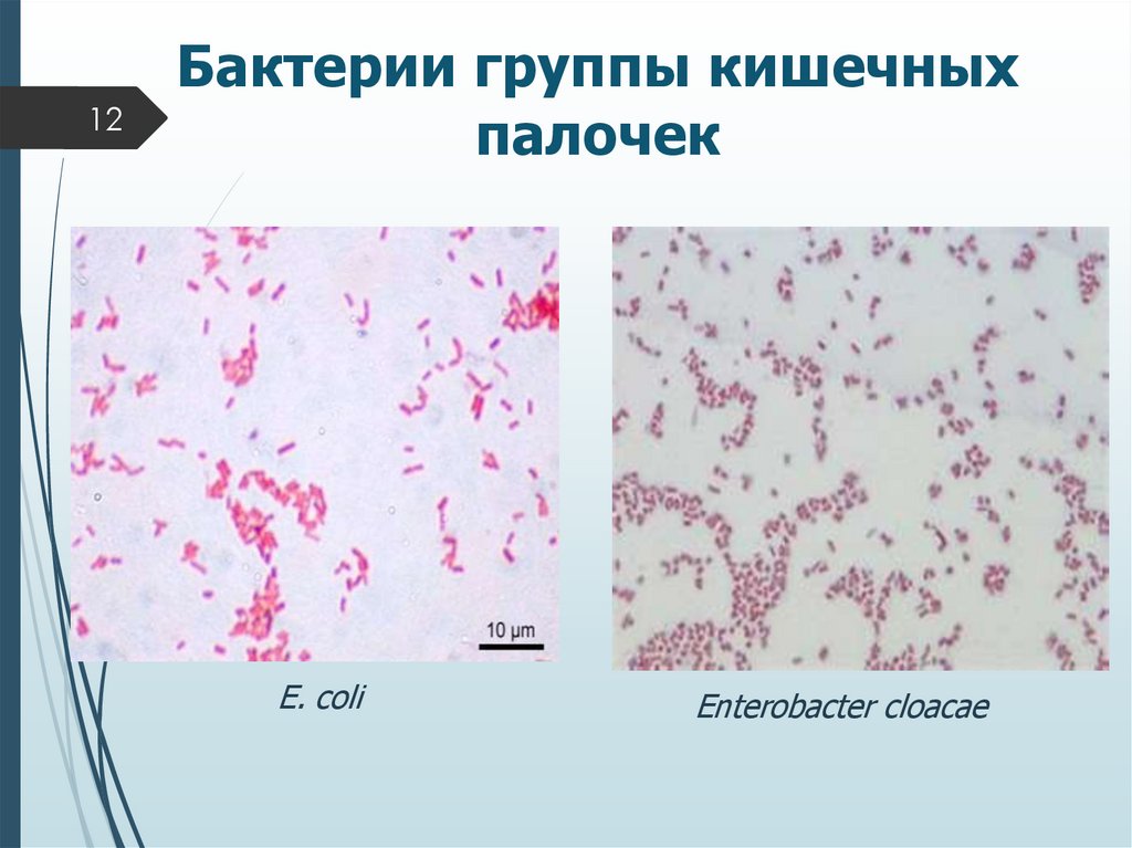 Бактерии группы кишечных палочек