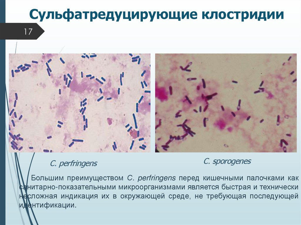 Сульфатредуцирующие клостридии