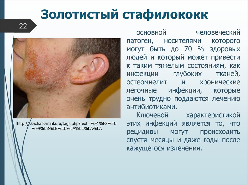 Золотистый стафилококк