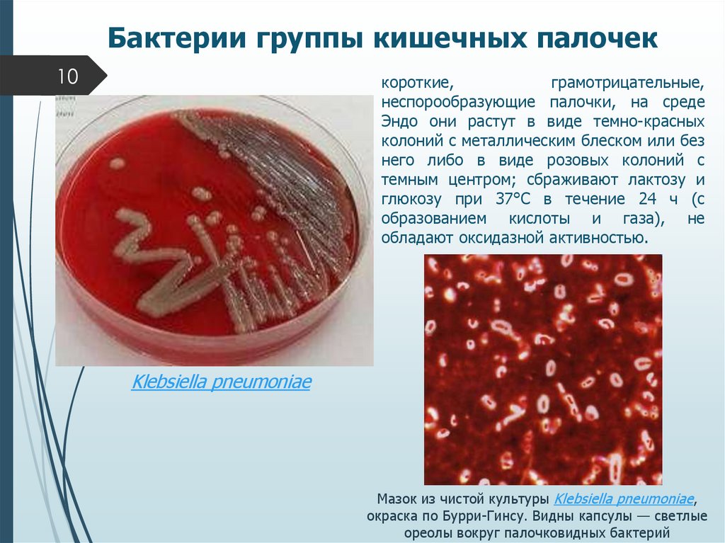 Бактерии группы кишечных палочек