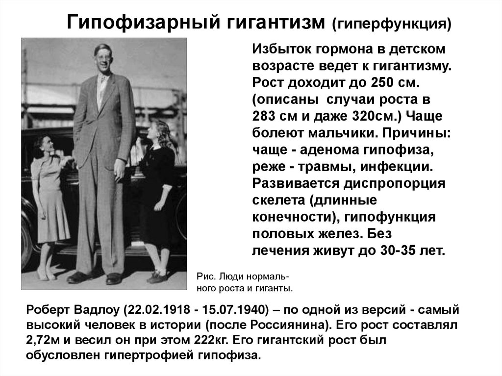 Гипофизарный гигантизм (гиперфункция)