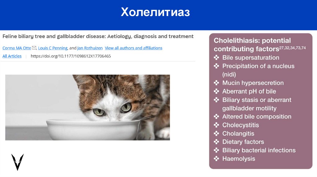 Холелитиаз