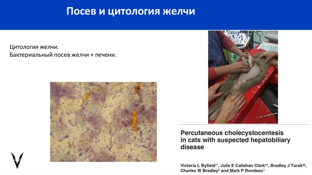 Посев и цитология желчи