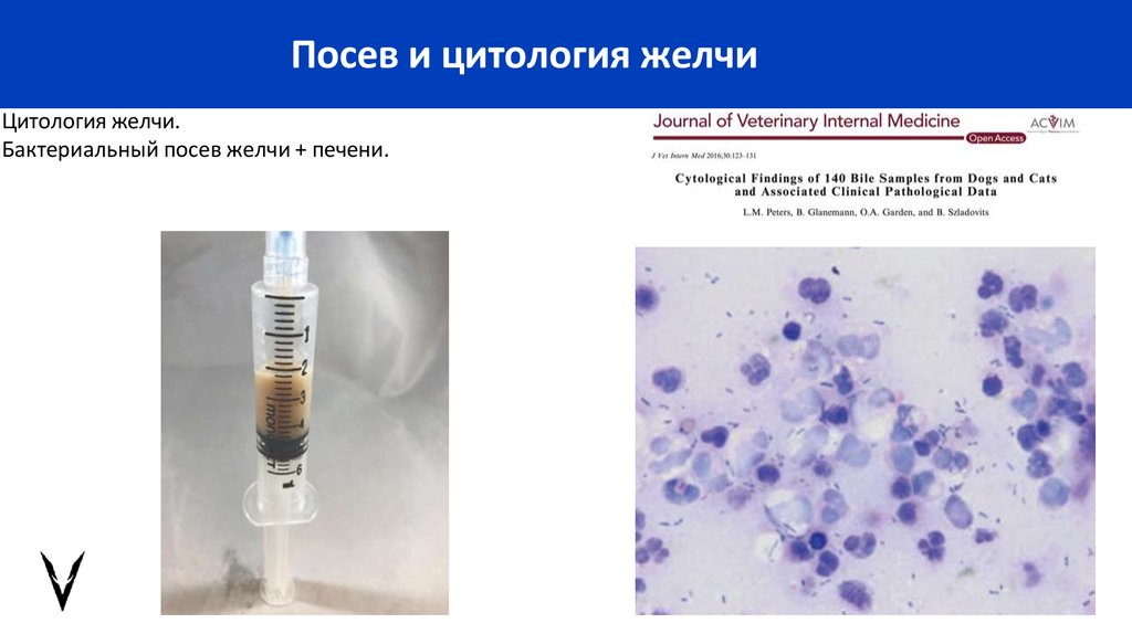 Посев и цитология желчи