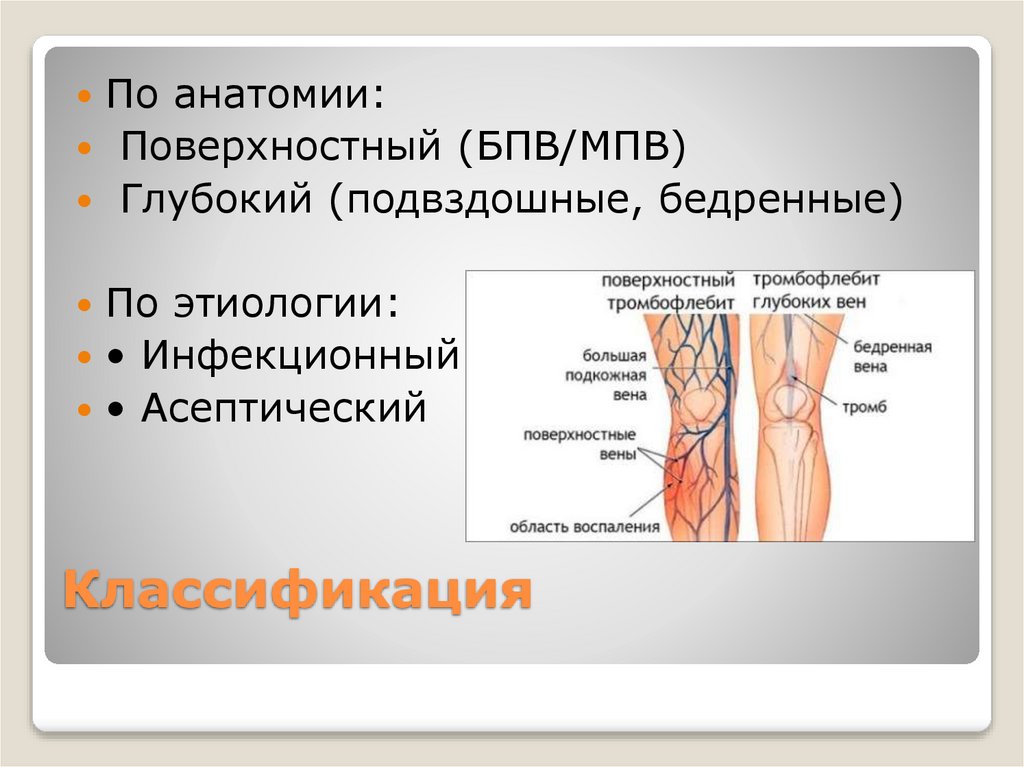 Классификация