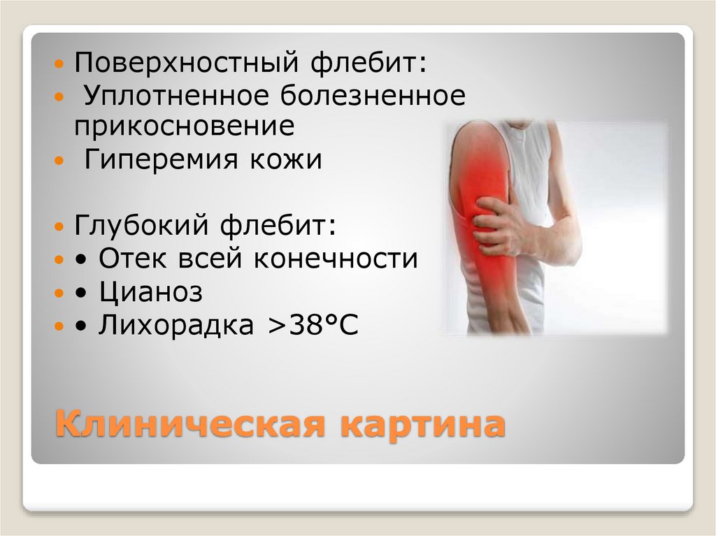 Клиническая картина