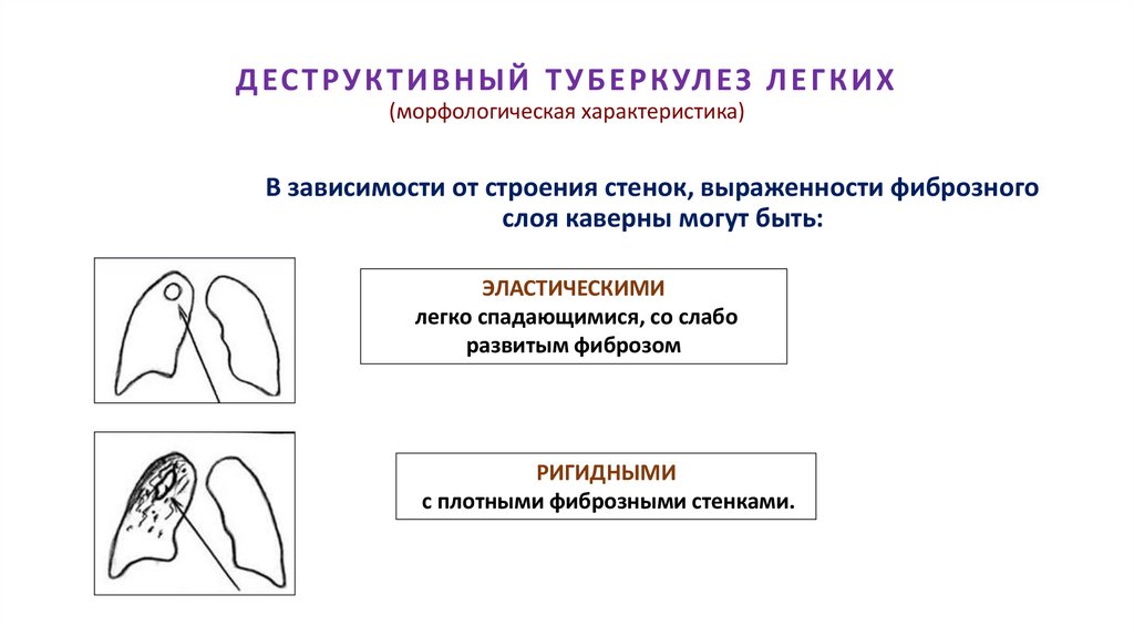 ДЕСТРУКТИВНЫЙ ТУБЕРКУЛЕЗ ЛЕГКИХ (морфологическая характеристика)