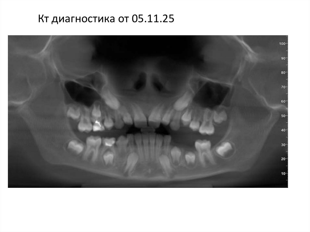 Кт диагностика от 05.11.25