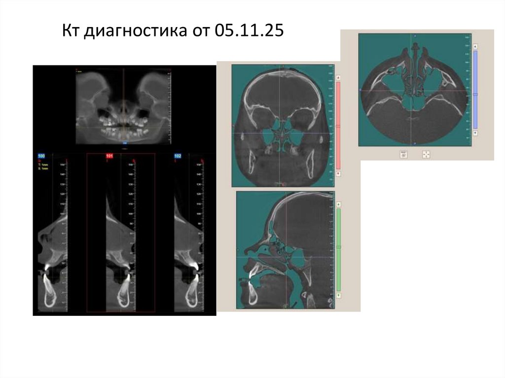 Кт диагностика от 05.11.25