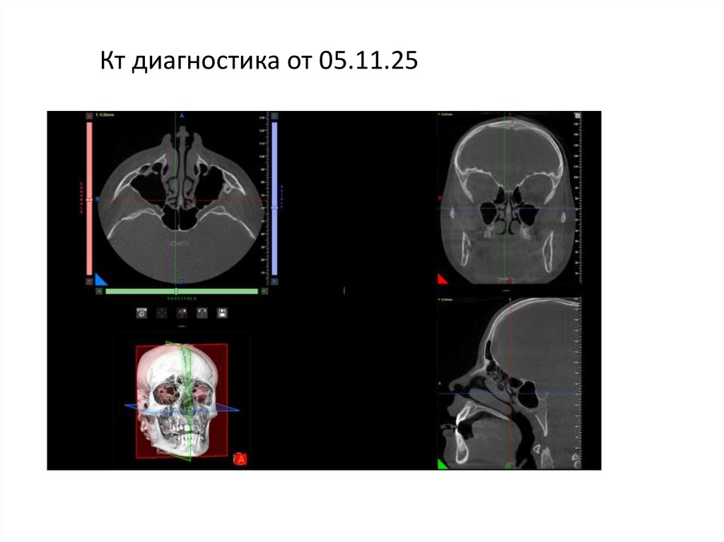 Кт диагностика от 05.11.25