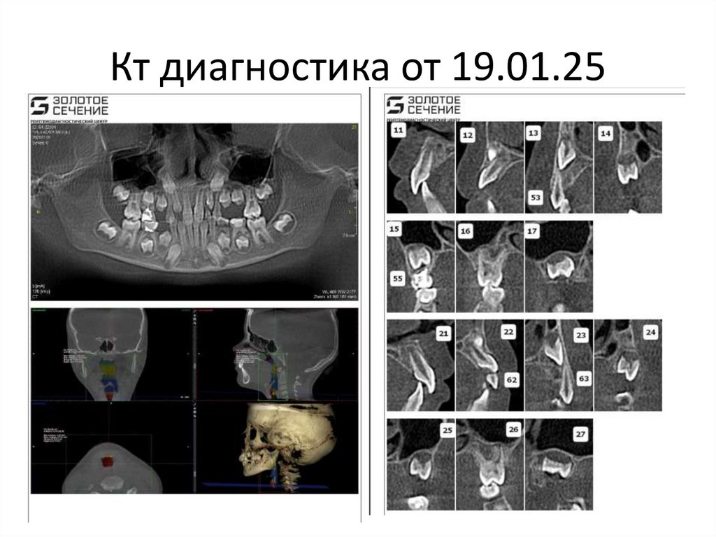 Кт диагностика от 19.01.25