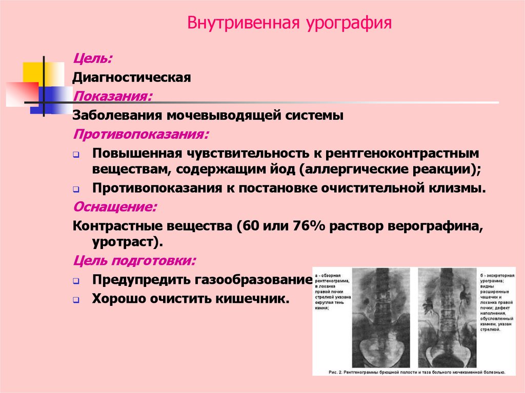 Внутривенная урография