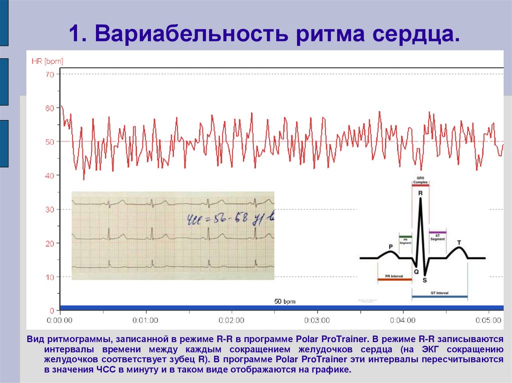 1. Вариабельность ритма сердца.