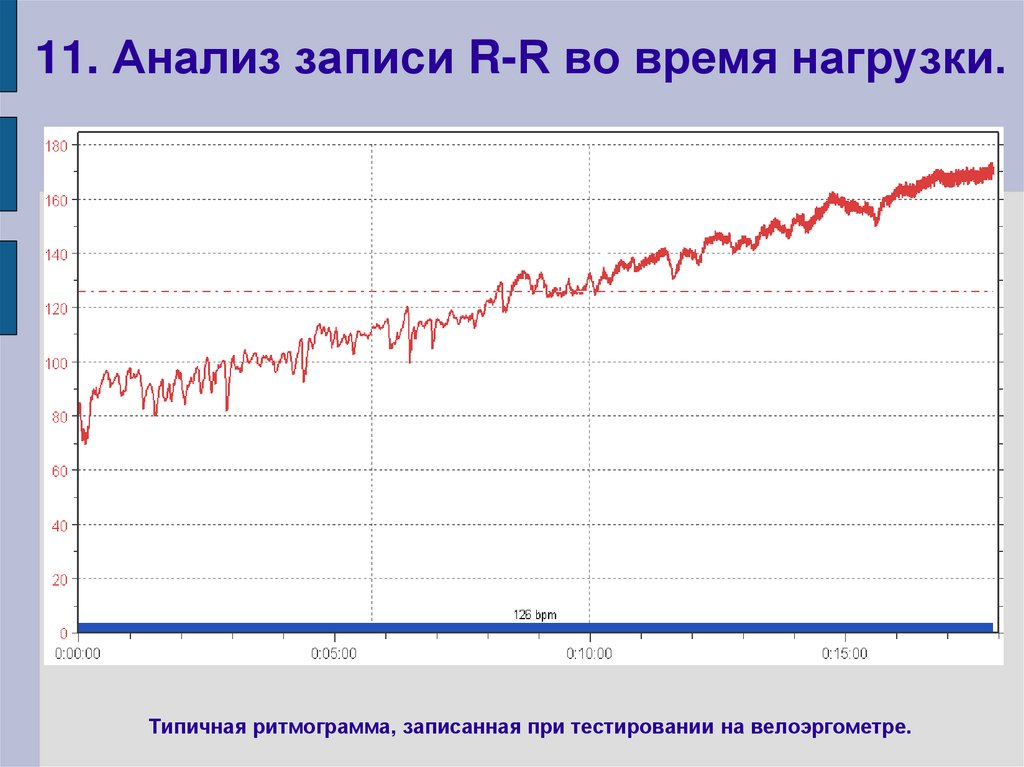 11. Анализ записи R-R во время нагрузки.