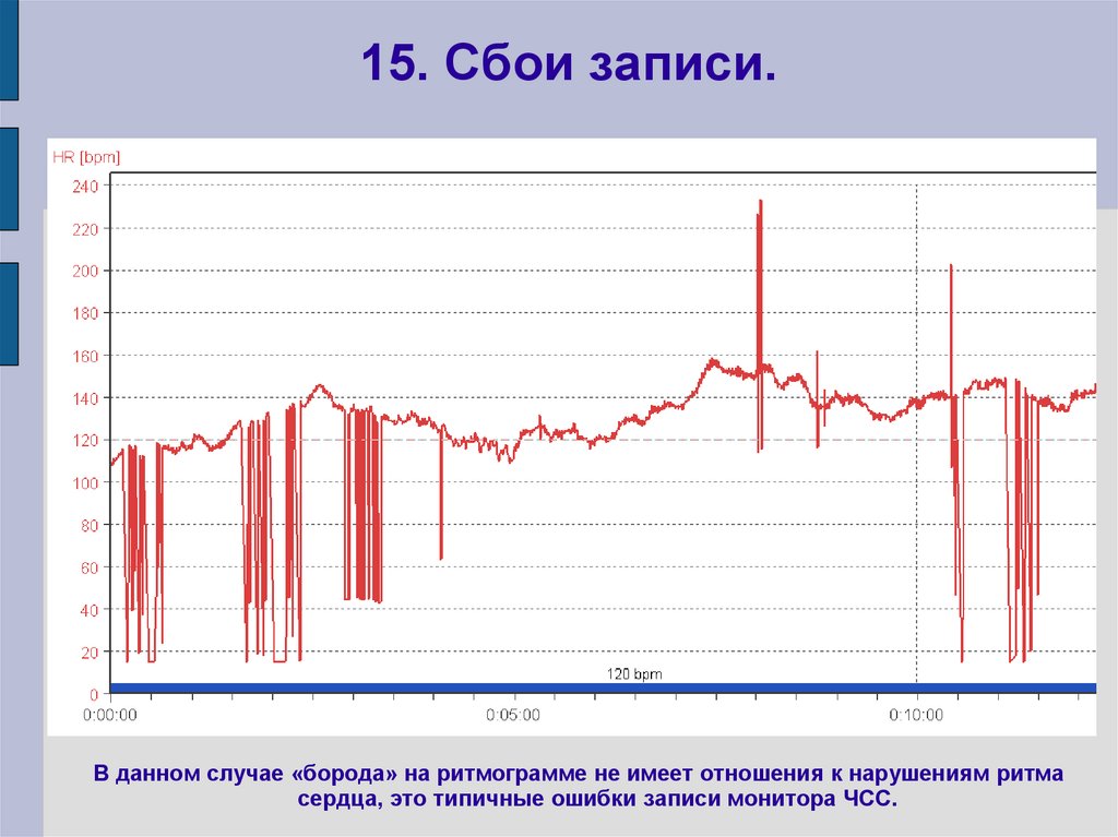 15. Сбои записи.