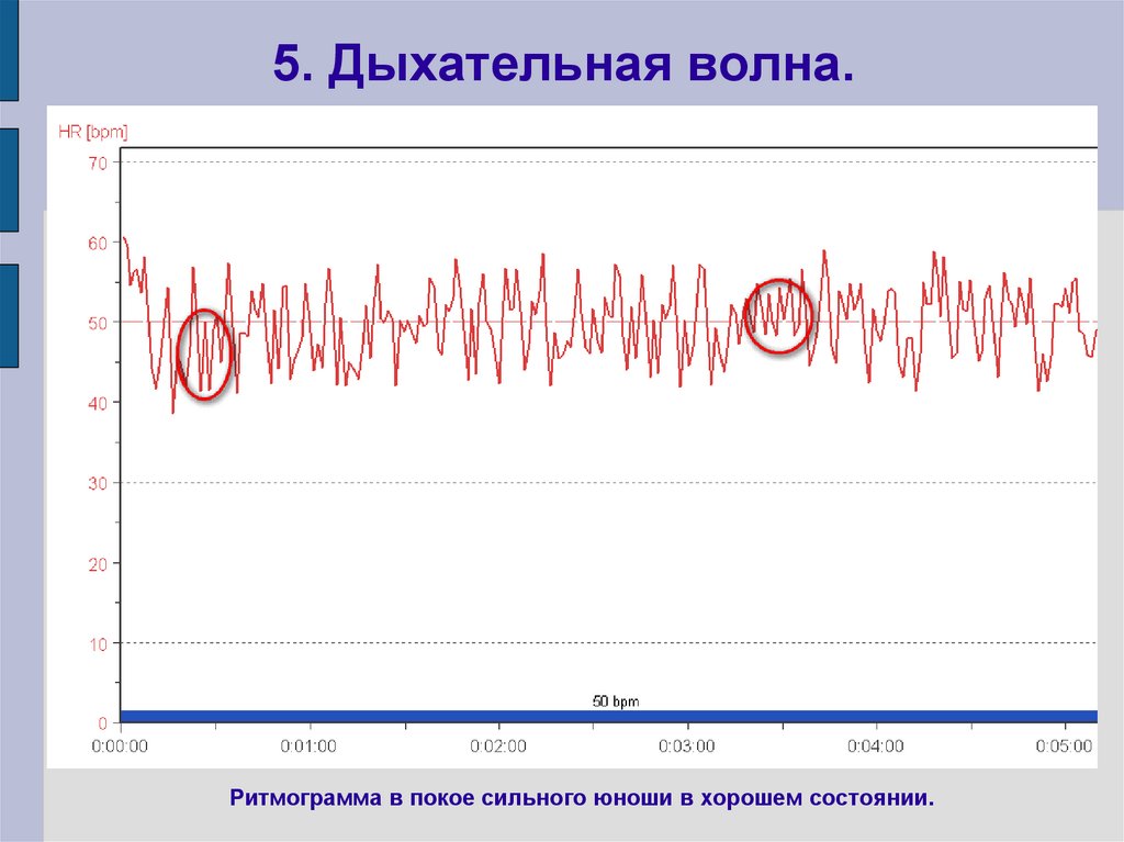 5. Дыхательная волна.