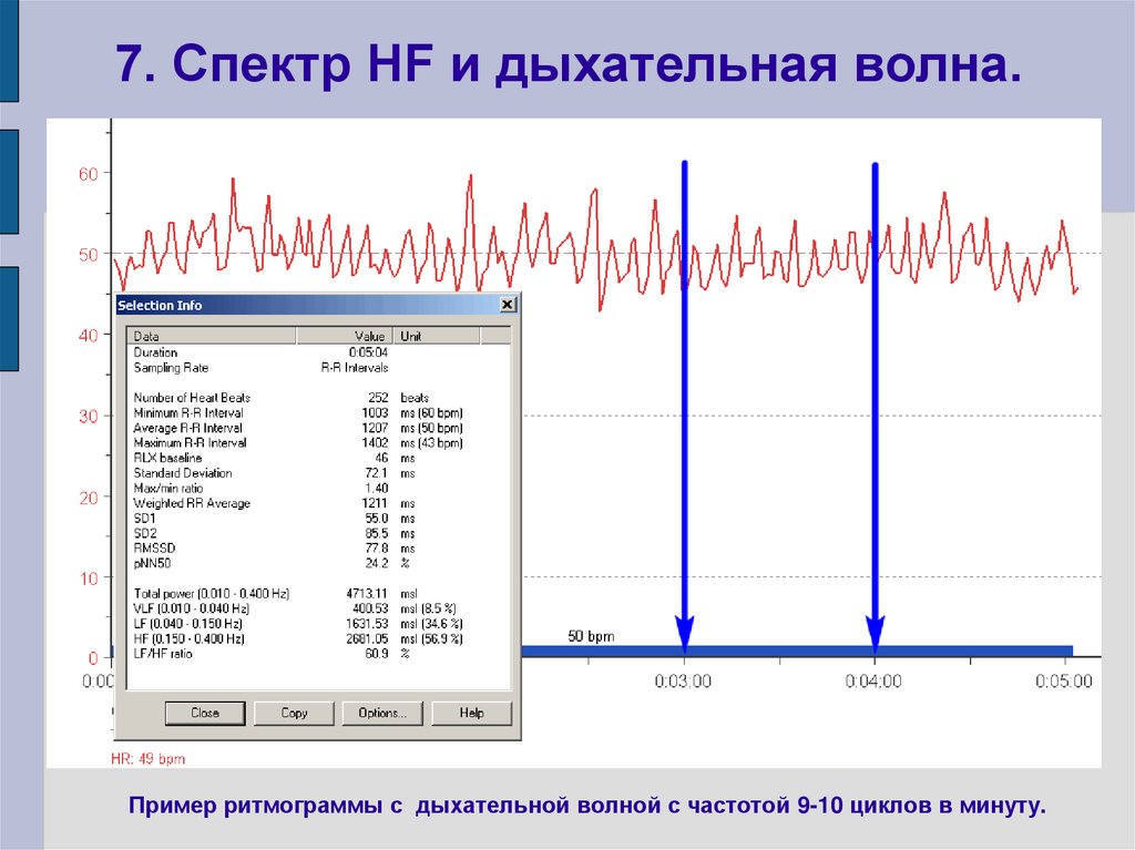 7. Спектр HF и дыхательная волна.