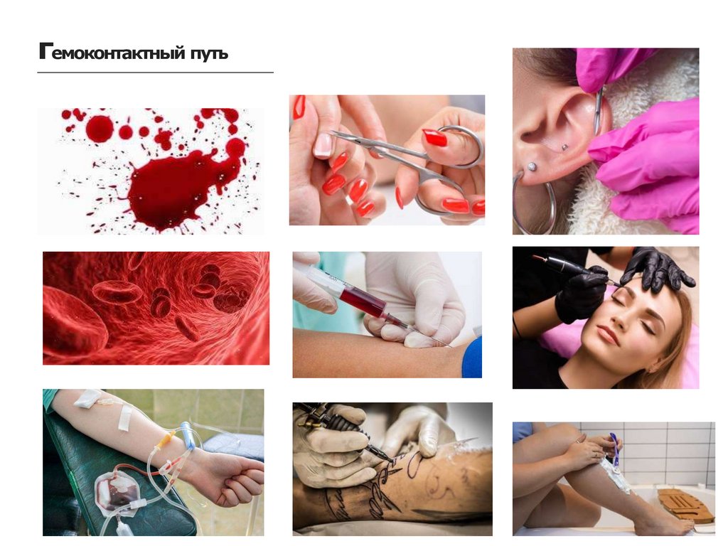 гемоконтактный путь
