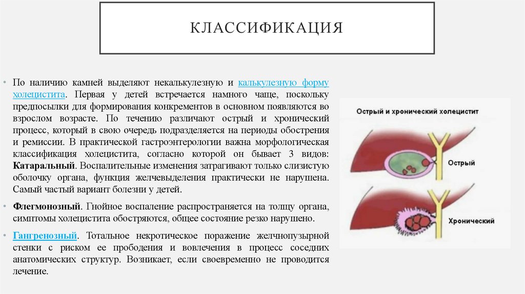 Классификация