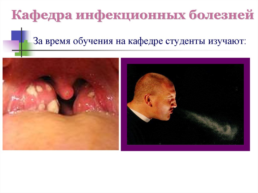 Кафедра инфекционных болезней