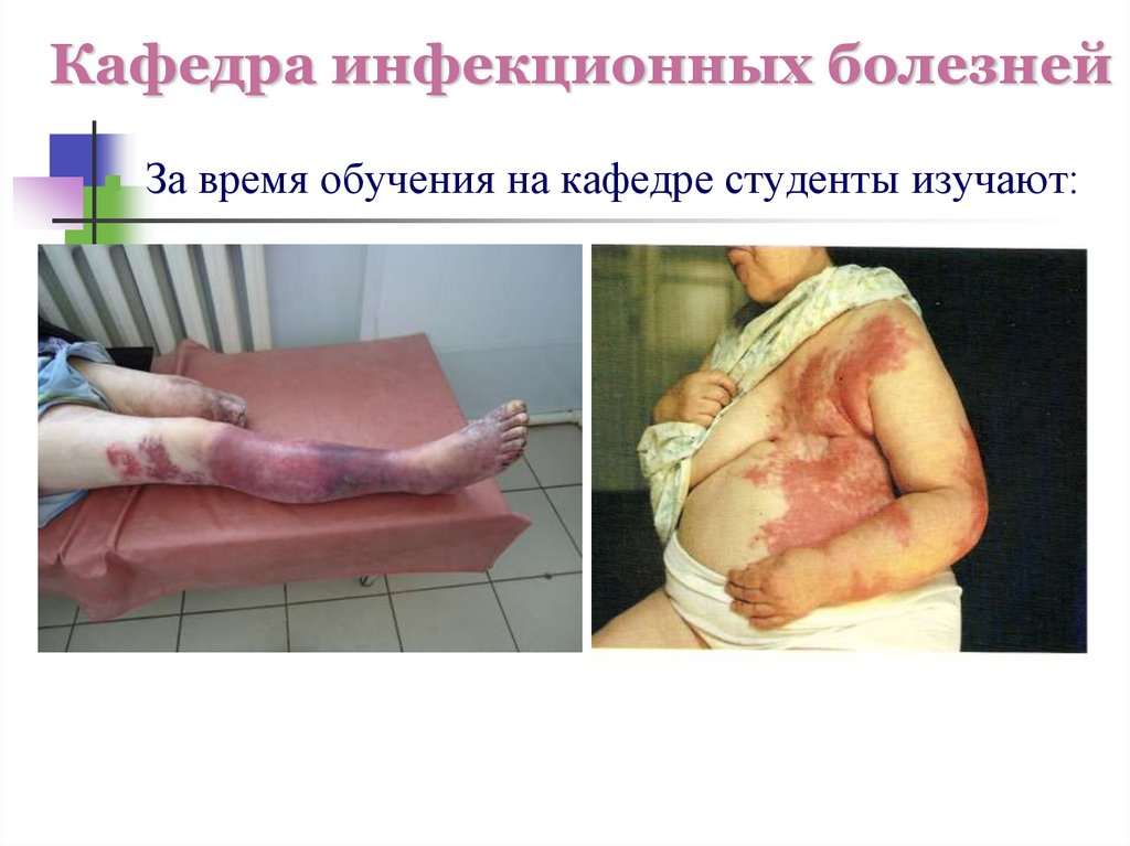 Кафедра инфекционных болезней