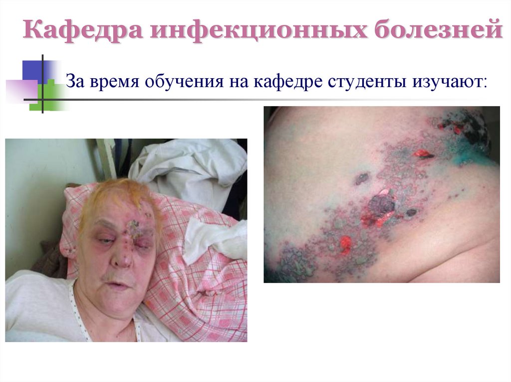 Кафедра инфекционных болезней