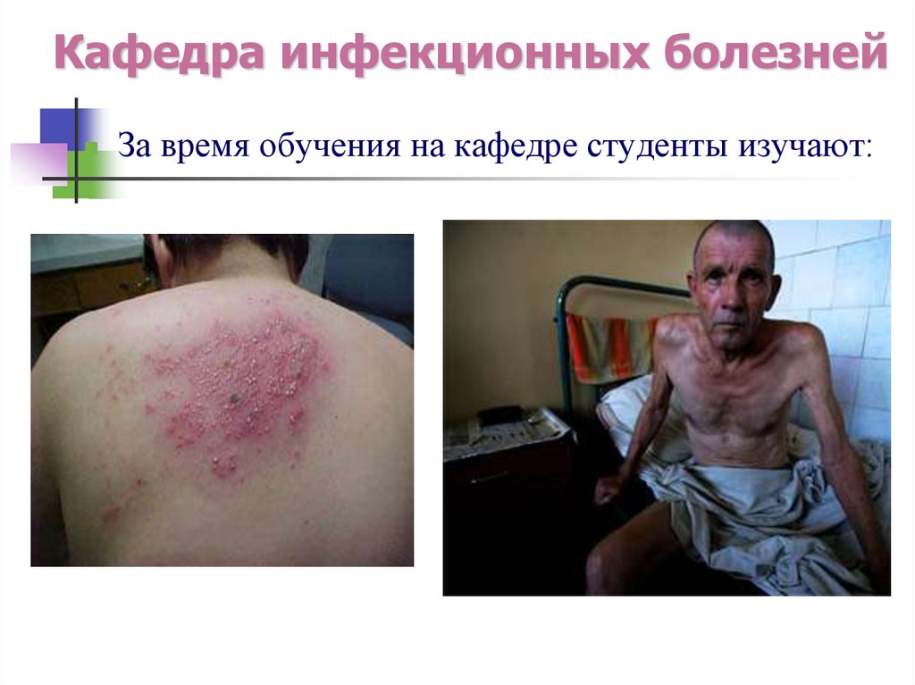 Кафедра инфекционных болезней