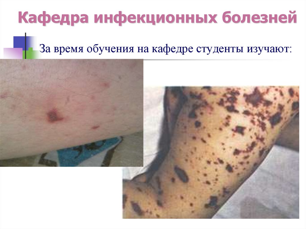 Кафедра инфекционных болезней