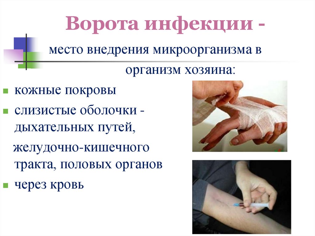 Ворота инфекции -