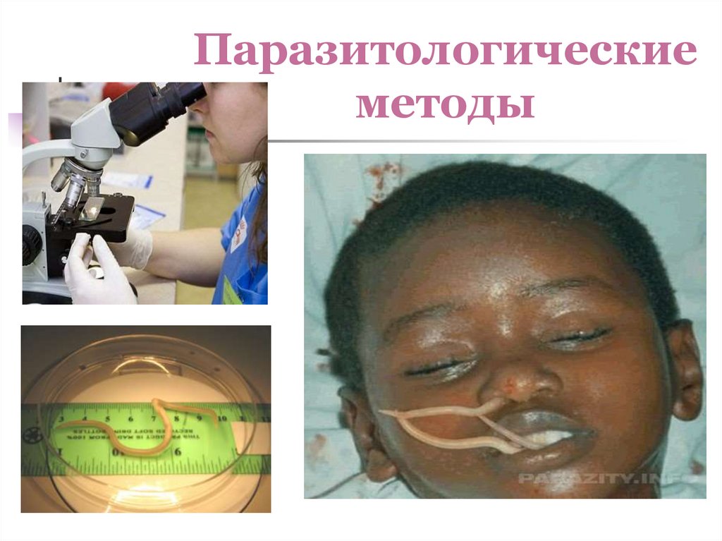 Паразитологические методы
