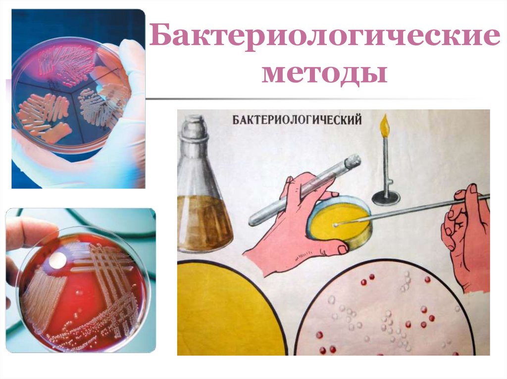Бактериологические методы