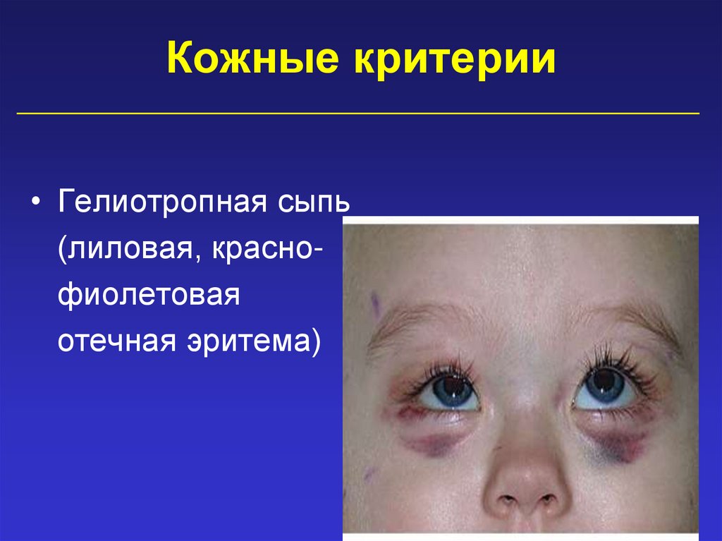 Кожные критерии