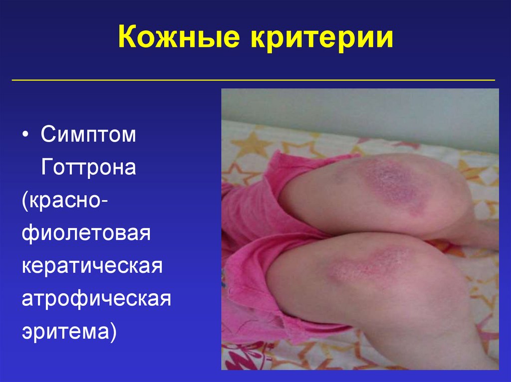 Кожные критерии