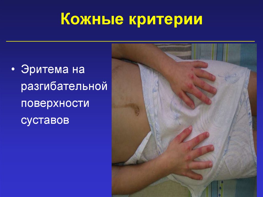 Кожные критерии